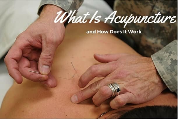 What Is Acupuncture and How Does It Work What Is Acupuncture and How Does It Work