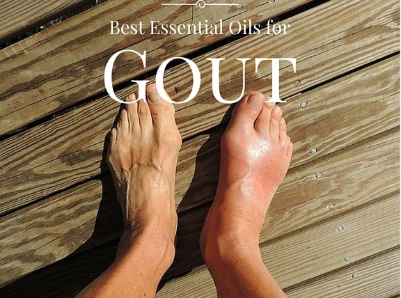 Essential Oils for Gout