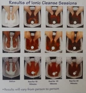 ionic foot bath worms