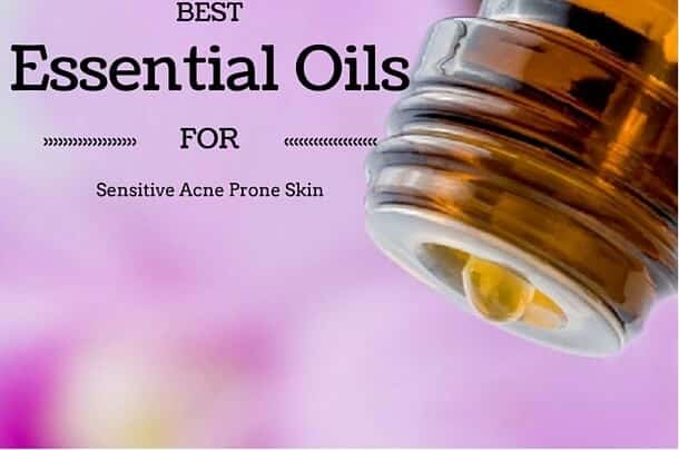 Best Essential Oils for Sensitive Acne Prone Skin Best Essential Oils for Sensitive Acne Prone Skin