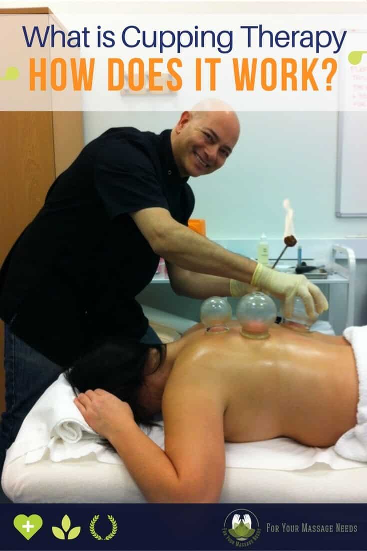 Cupping massage therapy Cupping massage therapy