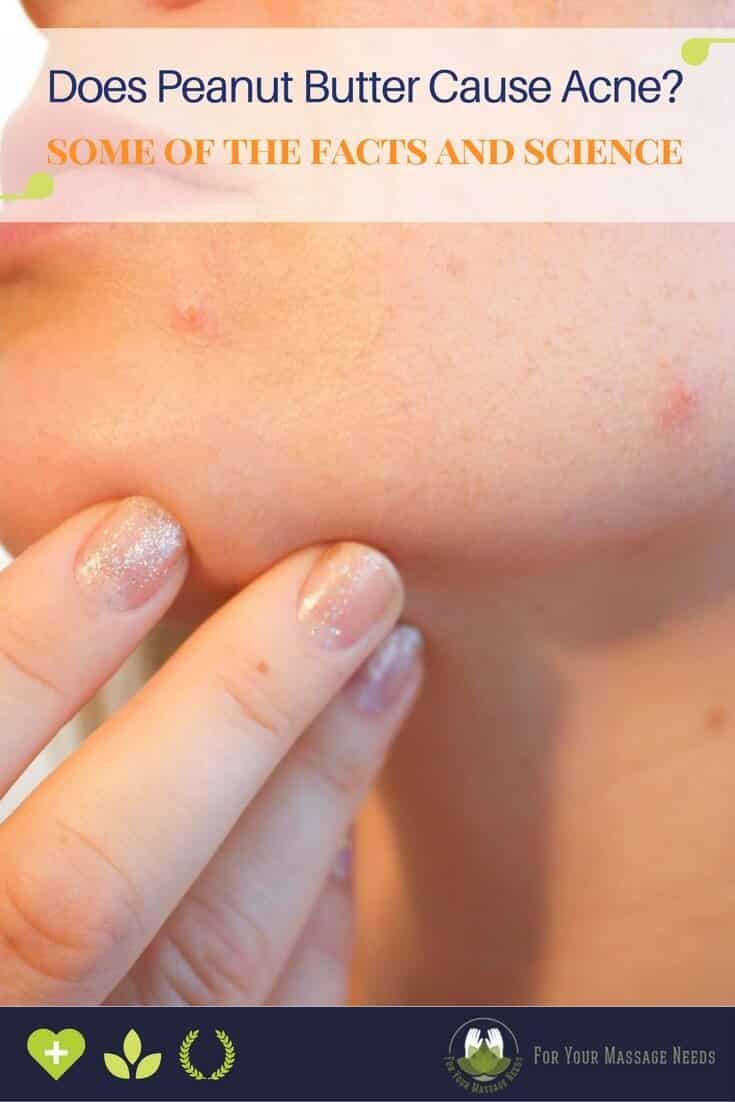 Does Peanut Butter Cause Acne Does Peanut Butter Cause Acne