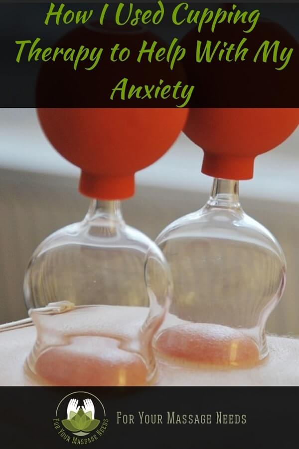 Cupping for Anxiety Cupping for Anxiety